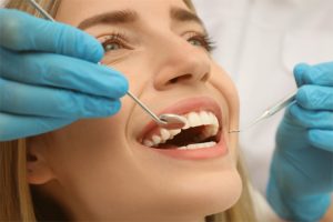 Cosmetic dental procedures Vancouver patient before and after | Long-lasting porcelain veneers Vancouver | Smile makeover results Vancouver